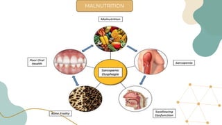 MALNUTRITION
 