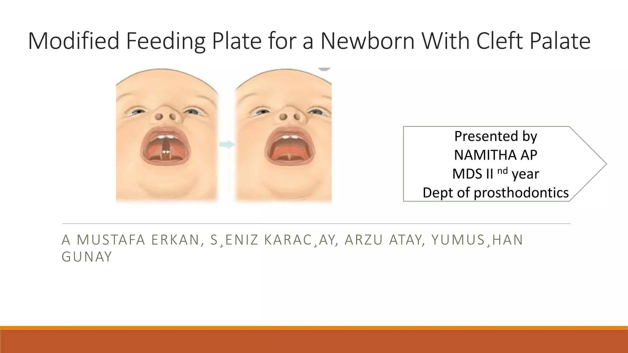 JOURNAL CLUB PRESENTATION IN PROSTHODONTICS ON FEEDING APPLIANCES USED