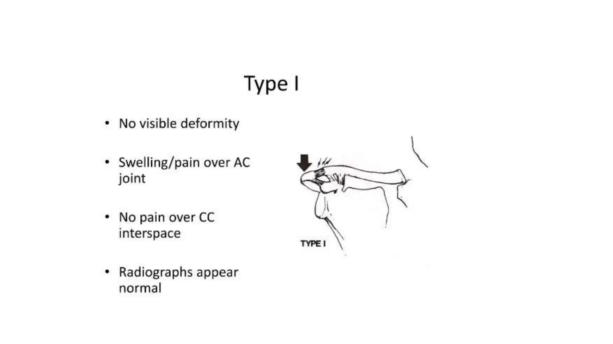 JC Acromioclavicular joint injuries.pptx