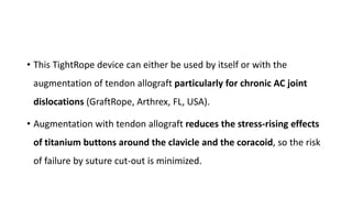 • This TightRope device can either be used by itself or with the
augmentation of tendon allograft particularly for chronic AC joint
dislocations (GraftRope, Arthrex, FL, USA).
• Augmentation with tendon allograft reduces the stress-rising effects
of titanium buttons around the clavicle and the coracoid, so the risk
of failure by suture cut-out is minimized.
 