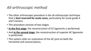 All-arthroscopic method
• The other arthroscopic procedure is the all-arthroscopic technique
that is best reserved for acute cases, particularly for acute grade 4
and 5 lesions.
• This procedure consists of two stages.
• In the first stage, the reconstruction of CC ligaments is performed,
• And in the second stage, the reconstruction of superior AC ligaments
is performed.
• This system relies on restoration of the AC joint on both the
horizontal and coronal planes,
 