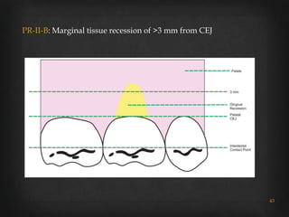 Rt Classification Gingival recession classifications | PPTX