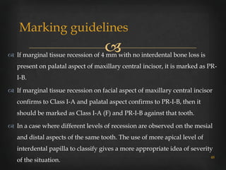 Gingival recession classifications | PPTX