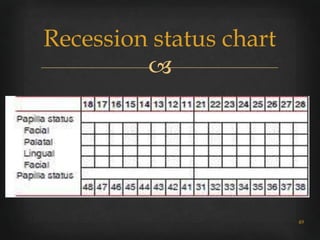 Gingival recession classifications | PPTX