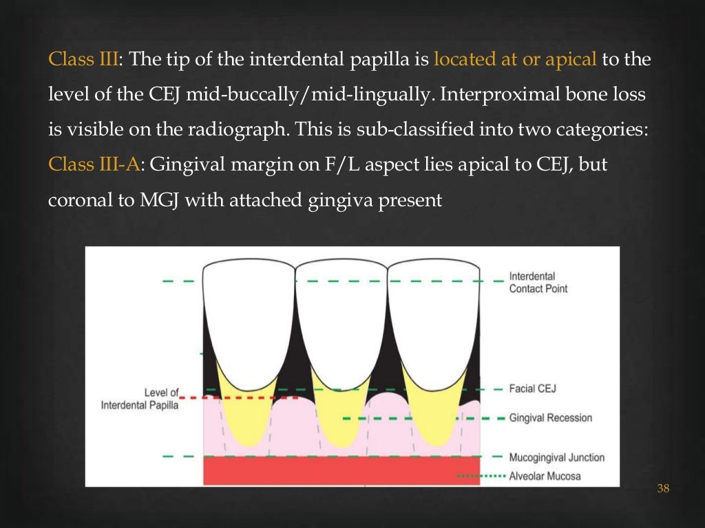 Gingival recession classifications