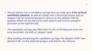 conventional syringe and needleless jet anesthesia.pptx