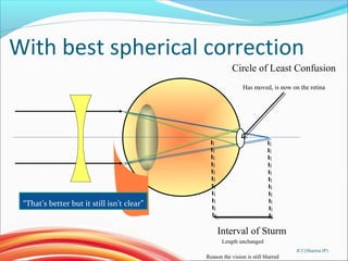 With best spherical correction
Circle of Least Confusion
Has moved, is now on the retina
Interval of Sturm
Length unchanged
Reason the vision is still blurred
“That’s better but it still isn’t clear”
JCC(Sharma IP)
 