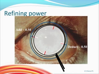 Refining power
JCC(Sharma IP)
Add – 0.50
Deduct – 0.50
 