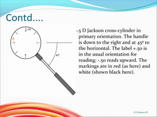 Contd....
0.5 D Jackson cross-cylinder in
primary orientation. The handle
is down to the right and at 45º to
the horizonta...