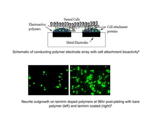 A novel implantable dual microelectrode for monitoring/predicting post ...