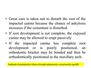 Management of maxillary canine impaction | PPTX