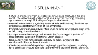 JC FISTULA IN ANO.pptx management and clinical features | PPTX