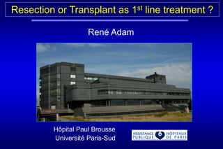 Hôpital Paul Brousse
Université Paris-Sud
René Adam
Resection or Transplant as 1st line treatment ?
 