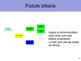 15
Fistule biliaire
drainage
J10 < 100 ml/j
garder le
drainage
J10 > 100 ml/j
canal biliaire
périphérique
embolisation
portale
colllage du
trajet
canal biliaire
hilaire
prothèse
endoscopique
persistanace à
6 mois
chirurgie
hépatectomie
réparation
TH
autre ?
- risque si communication
avec avec une voie
biliaire importante
- La bile lyse vite les colles
de fibrine
 