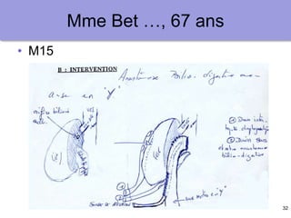 32
Mme Bet …, 67 ans
• M15
 