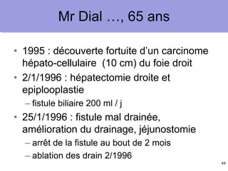44
Mr Dial …, 65 ans
• 1995 : découverte fortuite d’un carcinome
hépato-cellulaire (10 cm) du foie droit
• 2/1/1996 : hépatectomie droite et
epiplooplastie
– fistule biliaire 200 ml / j
• 25/1/1996 : fistule mal drainée,
amélioration du drainage, jéjunostomie
– arrêt de la fistule au bout de 2 mois
– ablation des drain 2/1996
 