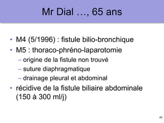 45
Mr Dial …, 65 ans
• M4 (5/1996) : fistule bilio-bronchique
• M5 : thoraco-phréno-laparotomie
– origine de la fistule non trouvé
– suture diaphragmatique
– drainage pleural et abdominal
• récidive de la fistule biliaire abdominale
(150 à 300 ml/j)
 