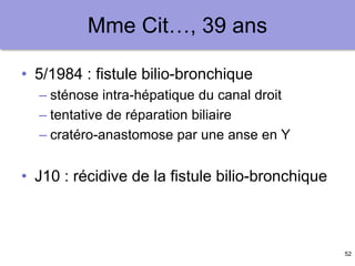 52
Mme Cit…, 39 ans
• 5/1984 : fistule bilio-bronchique
– sténose intra-hépatique du canal droit
– tentative de réparation biliaire
– cratéro-anastomose par une anse en Y
• J10 : récidive de la fistule bilio-bronchique
 