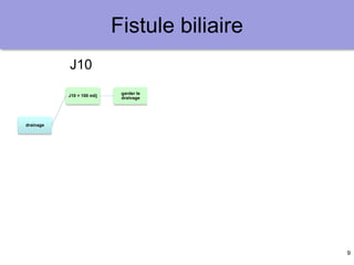 9
Fistule biliaire
drainage
J10 < 100 ml/j
garder le
drainage
J10 > 100 ml/j
canal biliaire
périphérique
embolisation
portale
Collage du
trajet
canal biliaire
hilaire
prothèse
endoscopique
persistanace à
6 mois
chirurgie
hépatectomie
réparation
TH
autre ?
J10
 
