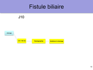 10
Fistule biliaire
drainage
J10 < 100 ml/j
garder le
drainage
J10 > 100 ml/j
canal biliaire
périphérique
embolisation
portale
Collage du
trajet
canal biliaire
hilaire
prothèse
endoscopique
persistanace à
6 mois
chirurgie
hépatectomie
réparation
TH
autre ?
J10
fistulographiej Améliorer le drainage
 