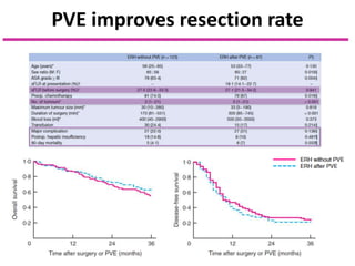 PVE improves resection rate
 