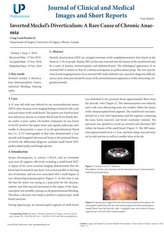 Inverted Meckel’s Diverticulum: A Rare Cause of Chronic Anae-
mia
Craig S and Pasieka JL*
Department of Surgery, University of Calgary, Alberta, Canada
Volume 1 Issue 3- 2018
Received Date: 17 Oct 2018
Accepted Date: 15 Nov 2018
Published Date: 19 Nov 2018
1. Abstract
Meckel’s diverticulum (MD) are vestigial remnants of the omphalomesenteric duct found in the
ileum in 1-2% of people. Rarely, MD can become inverted into the lumen of the small bowel and
be a cause of anemia, intussusception, and abdominal pain. The radiological appearance of an
inverted MD is similar to that of a submucosal lipoma or pedunculated polyp. The non-specific
clinical and imaging features of an inverted MD make definitive pre-operative diagnosis difficult,
and as such, clinicians should be aware of the presentationand appearance of this interesting con-
genital anomaly.
Journal of Clinical and Medical
Images and Short Reports
Citation: Craig S and Pasieka JL, Inverted Meckel’s Diverticulum: A Rare Cause of Chronic Anaemia. 2018;
1(3ss): 1-2.
United Prime Publications: http://unitedprimepub.com
*Corresponding Author (s): Janice L Pasieka, Department of Surgery, University of Cal-
gary, Canada, Tel:+1 403-944-2491; Fax: +1 403-283-4130; E-mail: Janice.pasieka@ahs.ca
Case Report
2. Key words
Inverted meckel; S diverticu-
lum; Intussusception; Gastro-
intestinal bleeding; Enterog-
raphy
3. Case
A 47-year-old male was referred to our neuroendocrine tumor
(NET) clinic because of an imaging finding consistent with a sub
mucosal tumor of the small bowel. The patient was found to have
iron deficiency anemia on routine blood tests by his family doc-
tor earlier 4 years earlier. On further evaluation, he was found
to be FIT positive, but upper, lower and capsule endoscopy were
unable to demonstrate a cause of occult gastrointestinal blood
loss [1]. A CT enterography at that time demonstrated a 5cm
smooth and elongated sub mucosal lesion in the proximal ileum,
of which the differential diagnosis included small bowel NET,
pedunculated polyp and benign lipoma.
4. Introduction
Serum chromogranin A, urinary 5-HIAA, and an octreotide
scan were all negative, effectively excluding a small bowel NET.
A repeat of his cross-sectional imaging demonstrated that the
lesion had increased in size from 5cm to 8cm parallel to the long
axis of intestine, and was now associated with a small degree of
non-obstructing intussusception (Figure 1). At this time it was
felt that the lesion was acting as a lead point for the intussus-
ception, and that mucosal ulceration in the region of the intus-
susception was possibly causing occult gastrointestinal bleeding.
Therefore, a decision was made to perform a laparoscopic small
bowel resection.
During laparoscopy, an intussuscepted segment of small bowel
was identified in the proximal ileum approximately 90cm from
the ileocolic valve (Figure 2). The intussusception was reduced,
and a soft, non-obstructing mass was evident within the lumen
of the intussuscepted bowel segment. The small bowel was exter-
iorized via a 5cm mini-laparotomy and the segment containing
the mass lesion resected, and bowel continuity restored. The
specimen was opened to reveal an inverted and ulcerated MD
within the lumen of the small bowel (Figure 3). The MD meas-
ured approximately 6cm x 1.5cm, and had a large mucosal ulcer
on its mid-portion as well as a smaller ulcer at the tip.
Figure 1: Coronal view of CT abdomen.
Description: An 8cm intra-luminal and fat-attenuation lesion is demonstrated
within the proximal ileum.
Figure 2: Laparoscopic image of the ileo-ileal intussusception Description: On
running the small bowel, this ileo-ileal intussusception was discovered approx-
imately 90cm from the ileocolic valve. A palpable mass was evident in bowel
segment just to the left of the intussusception.
 