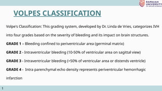JC NEONATAL SEIZURES 3.pptxvvvvvvvvvvvvv | PPTX