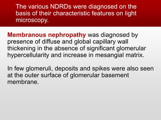 Ndrd Non‑diabetic renal disease in type 2 diabetes mellitus: Study of renal ...