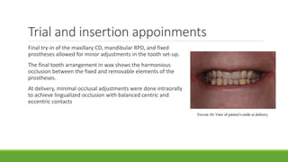 Rpd Try In Journal club presentation on lingualised occlusion | PPTX