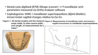 Comprehensive Insights into Rapid Maxillary Expansion in Orthodontics ...