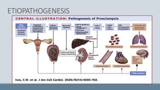 Pre eclampsia diagnosis by uterine artery doppler | PPTX