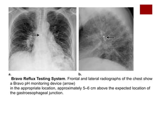 Radiographic Review of Current Therapeutic and Monitoring Devices in ...
