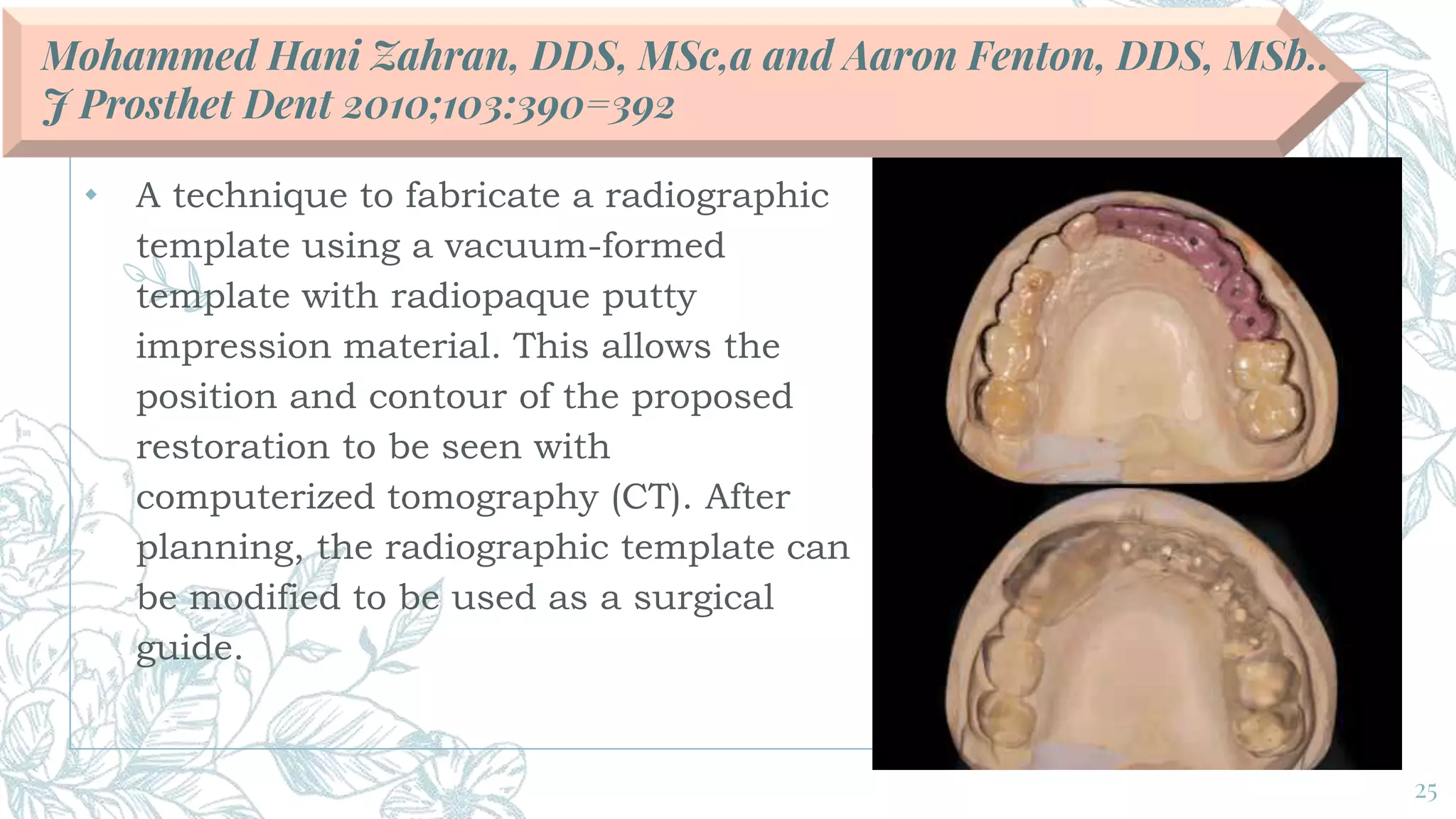 Surgical guide_ journal club | PPTX