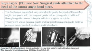 Inclination Guide Str Surgical guide_ journal club | PPTX