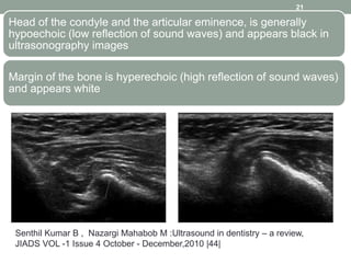 Head of the condyle and the articular eminence, is generally
hypoechoic (low reflection of sound waves) and appears black in
ultrasonography images
Margin of the bone is hyperechoic (high reflection of sound waves)
and appears white
21
Senthil Kumar B , Nazargi Mahabob M :Ultrasound in dentistry – a review,
JIADS VOL -1 Issue 4 October - December,2010 |44|
 