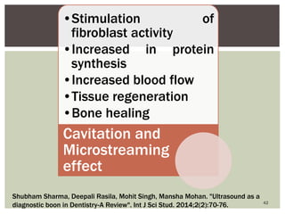 •Stimulation of
fibroblast activity
•Increased in protein
synthesis
•Increased blood flow
•Tissue regeneration
•Bone healing
Cavitation and
Microstreaming
effect
42
Shubham Sharma, Deepali Rasila, Mohit Singh, Mansha Mohan. "Ultrasound as a
diagnostic boon in Dentistry-A Review". Int J Sci Stud. 2014;2(2):70-76.
 