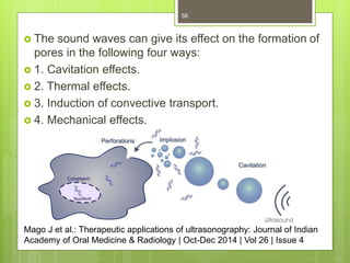  The sound waves can give its effect on the formation of
pores in the following four ways:
 1. Cavitation effects.
 2. Thermal effects.
 3. Induction of convective transport.
 4. Mechanical effects.
58
Mago J et al.: Therapeutic applications of ultrasonography: Journal of Indian
Academy of Oral Medicine & Radiology | Oct-Dec 2014 | Vol 26 | Issue 4
 