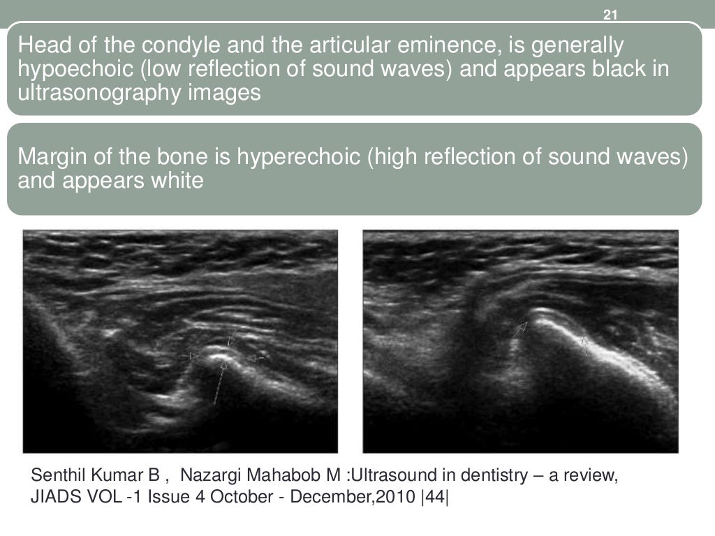 ultrasound in dentistry