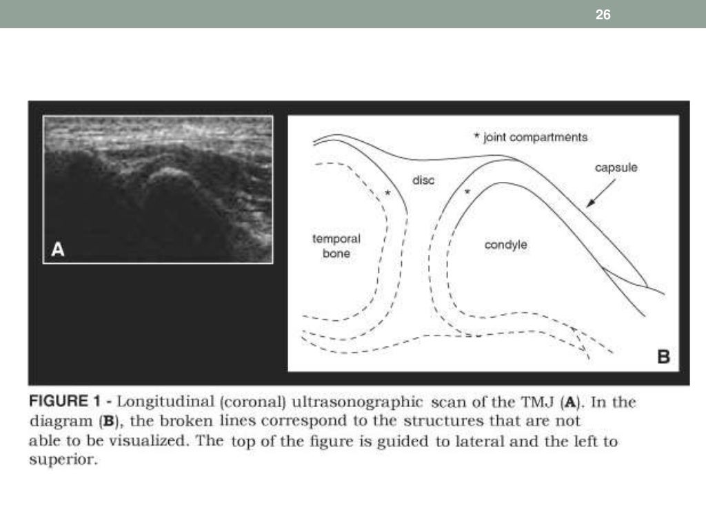 ultrasound in dentistry