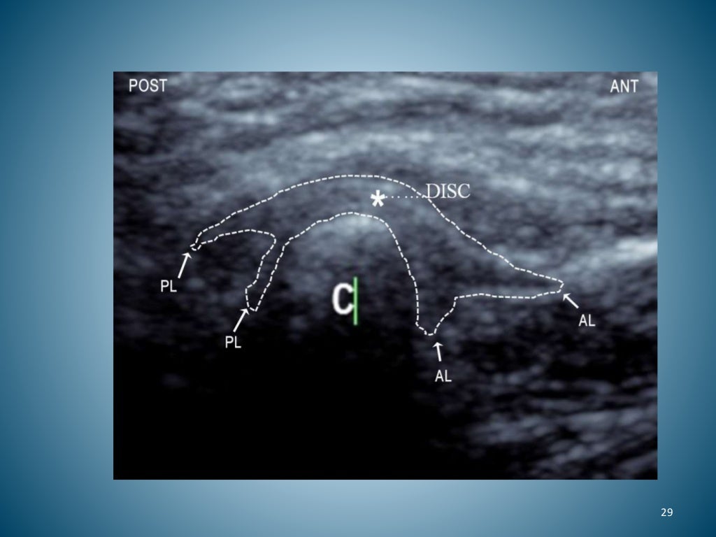 ultrasound in dentistry