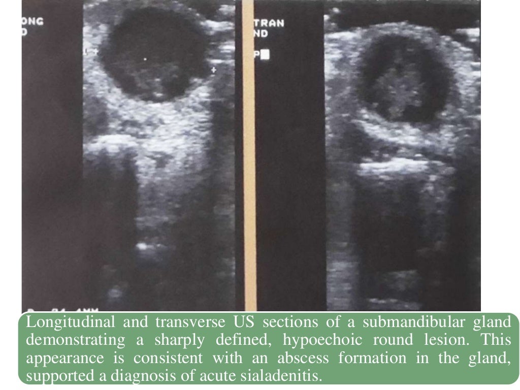 ultrasound in dentistry