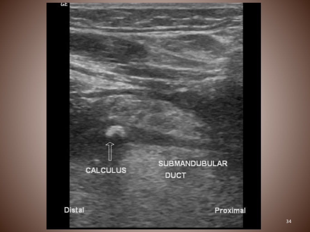 ultrasound in dentistry