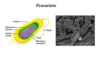 Procarioto
 