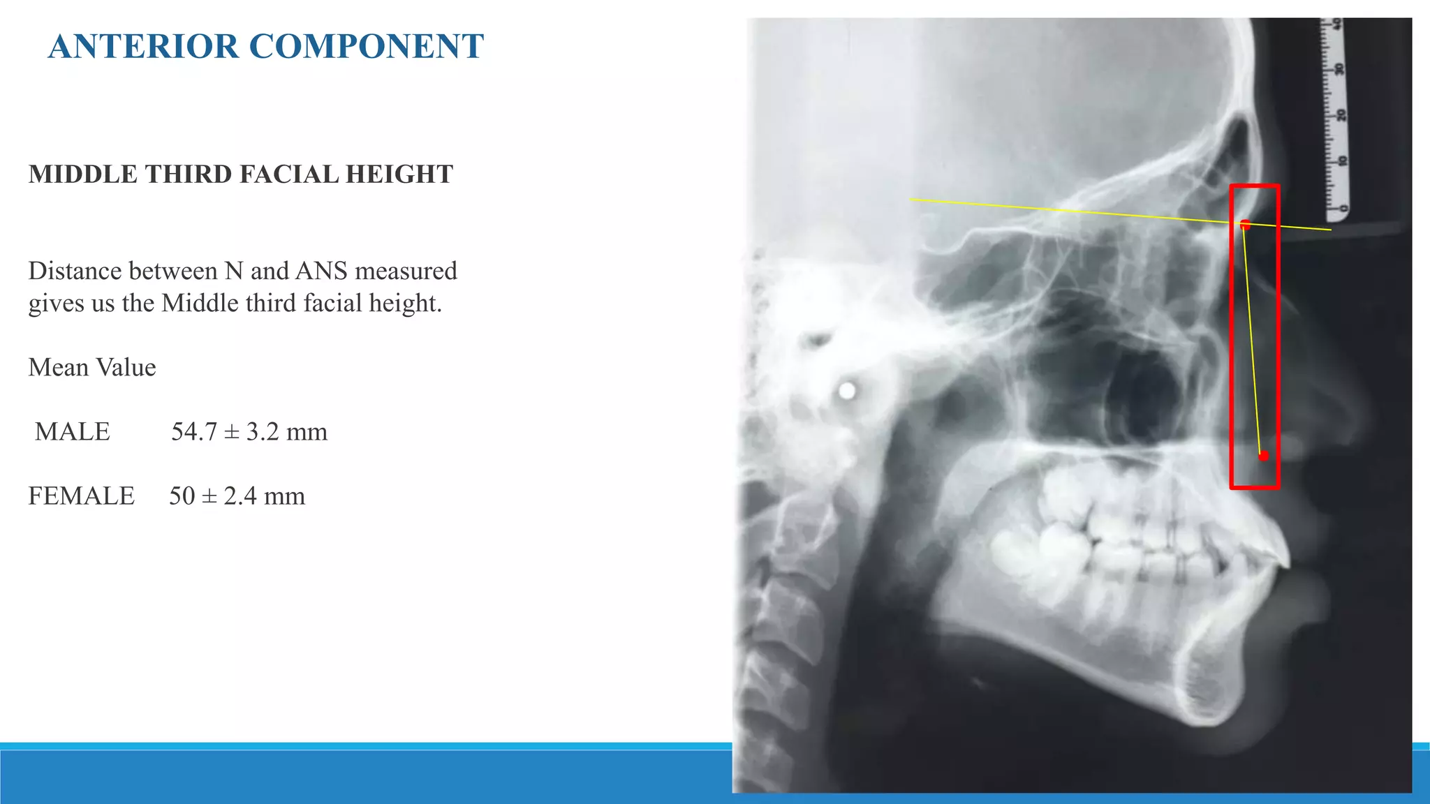 COGS Burstone analysis for orthognathic surgery | PPTX