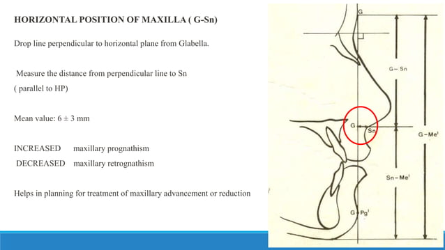 COGS Burstone analysis for orthognathic surgery | PPTX