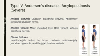 Type IV, Andersen's disease, Amylopectinosis
(Severe)
Affected enzyme: Glycogen branching enzyme. Abnormally
structured glycogen forms.
Affected tissues: Many, including liver. Rare variant affects
peripheral nerves.
Clinical features:
Hepatomegaly, failure to thrive, cirrhosis, splenomegaly,
jaundice, hypotonia, waddling gait, lumbar lordosis.
JD’sPharmacology
 