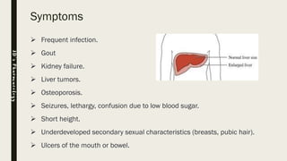 Symptoms
➢ Frequent infection.
➢ Gout
➢ Kidney failure.
➢ Liver tumors.
➢ Osteoporosis.
➢ Seizures, lethargy, confusion due to low blood sugar.
➢ Short height.
➢ Underdeveloped secondary sexual characteristics (breasts, pubic hair).
➢ Ulcers of the mouth or bowel.
JD’sPharmacology
 