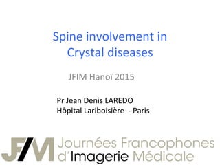 Spine	
  involvement	
  in	
  	
  
Crystal	
  diseases	
  
JFIM	
  Hanoï	
  2015	
  	
  
Pr	
  Jean	
  Denis	
  LAREDO	
  
Hôpital	
  Lariboisière	
  	
  -­‐	
  Paris	
  	
  
 