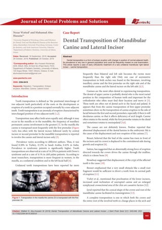 Citation: Watted N, Abu-Hussein M (2016) Dental Transposition of Mandibular Canine and Lateral Incisor. J Dent Probl Solut 3(1): 045-049. DOI:
10.17352/2394-8418.000034
Journal of Dental Problems and Solutions
045
Introduction
Tooth transposition is defined as ‘the positional interchange of
two adjacent teeth particularly of the roots or the development or
eruption of a tooth in a position occupied normally by a non-adjacent
tooth. Tooth transposition is an anomaly of eruption characterized by
interchanged position of two adjacent teeth [1,2].
Transposition may affect both sexes equally and, although it may
occur in the maxilla or in the mandible, the frequency of maxillary
permanent canine involvement is the greatest [3]. In the maxilla the
canine is transposed most frequently with the first premolar (Figure
1a,b), less often with the lateral incisor followed rarely by central
incisor or second premolar In the mandible transposition is reported
to involve the canine and lateral incisor only [3].
Prevalence varies according to different authors. Thus, it was
found 0.38% in Turkey, 0.13% in Saudi Arabia, 0.43% in India.
Prevalence in syndromic patients is significantly higher. Tooth
transpositions are observed at a rate of 14.29% in patients with Down’s
syndrome and at a rate of 4.1% in cleft palate patients. According to
most researchers, transposition is more frequent in women, in the
maxilla, as a unilateral condition and in the left facial half [4].
Unilateral tooth transpositions have been reported far more
Case Report
Dental Transposition of Mandibular
Canine and Lateral Incisor
Nezar Watted1
and Muhamad Abu-
Hussein2
* 
1
University Hospital of Würzburg, Clinics and Policlinics
for Dental, Oral and Maxillofacial Diseases of the Bavarian
Julius-Maximilian-University Wuerzburg, Germany, Center
for dentistry, and Arab American University, Palestine
2
Department of Pediatric Dentistry, University of Athens,
Greece
Dates: Received: 19 September, 2016; Accepted:
24 October, 2016; Published: 25 October, 2016
*Corresponding author: Abu-Hussein Muhamad,
DDS, MScD, MSc, M Dent Sci (Paed Dent), FICD,
Department of Pediatric Dentistry, University of Athens,
123 Argus Street, 10441 Athens, Greece, E-mail;
www.peertechz.com
ISSN: 2394-8418
Keywords: Migration; Transposition; Ectopic
eruption; Mandible; Canine; Lateral incisor 
Abstract
Dental transposition is a form of ectopic eruption with change in position of normal adjacent teeth.
Its prevalence is very low in general population and could be frequently missed on oral examination.
This article reports a case of early orthodontic treatment of a rare unilateral mandibular right lateral
incisor – canine transposition.
frequently than bilateral and left side becomes the victim more
frequently than the right side Only one case of asymmetric
transposition in both arches was found in the literature, involving
maxillary canine and the first premolar on the right side and of the
mandibular canine and the lateral incisor on the left side [4,5].
Canines are the most often dental in experiencing transposition.
The dental of upper canine is probably dental who is the most varied
position in the composition of human teeth and important for the
orthodontist who often must find their location and move it [3].
These teeth are often out of dental arch to the facial and palatal. It
appears that from the canine transposition of first upper premolar
sometimes show on the transposition of canine eruption in the side of
facial between the first and second premolars, especially if there is still
deciduous canine, so that it affects deficiency of arch length. Canine
often rotates to the mesial, while the first premolar rotates to the distal
and sometimes rotates to mesiopalatal [3,6].
The causes are not definitely known. Nodine reported that
abnormal displacement of the dental lamina in the embryonic life is
the cause of the displacement and non-eruption of the canines [7].
Bruszt, believed that the bud of the canine has risen in front of
the incisors and its crown is displaced to the contralateral side during
growth and eruption [8].
Sutton, has suggested that an abnormally strong force of eruption
directed towards the crown drives the canine through the midline,
which is a dense bone [9].
Broadway suggested that displacement of the crypt of the affected
tooth is the cause [10].
Bennet emphasized that a very small obstacle like a small root
fragment would be sufficient to divert a tooth from its normal path
of eruption [11].
Vichi1 et al., mentioned that proclination of the lower incisors,
increased axial inclination of unerupted canine and an enlarged
symphyseal crossectional area of the chin are causative factors [12].
Javid reported that the conical shape of the crown and root of the
mandibular canine facilitated its transmigration [13].
A complete transposition is one in which both the crown and
the entire root of the involved teeth ex-change places in the arch and
Figure 1: Transposition In the maxilla the canine-23-is transposed with the first
premolar 24.
 