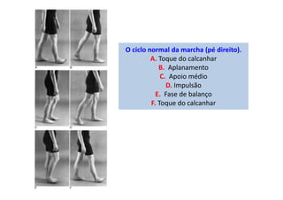 O ciclo normal da marcha (pé direito).
A. Toque do calcanhar
B. Aplanamento
C. Apoio médio
D. Impulsão
E. Fase de balanço
F. Toque do calcanhar
 